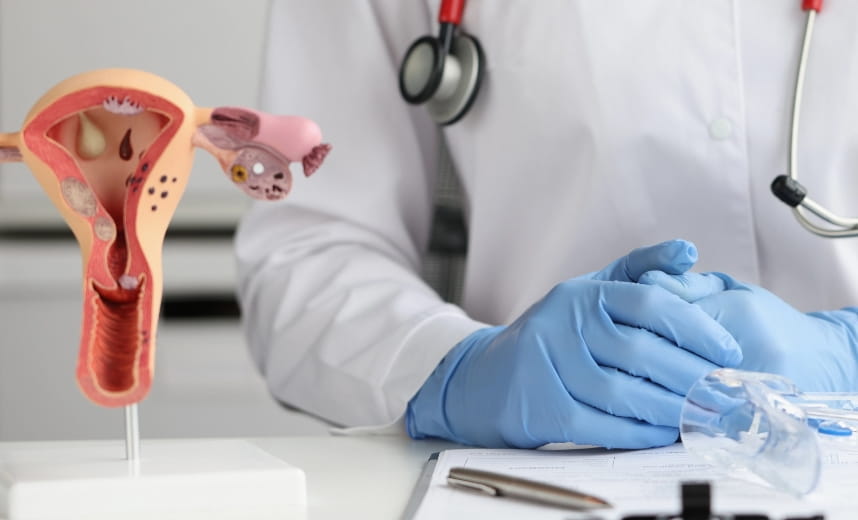 Anatomische Modelle von Gebärmutter und Eierstöcken in einer gynäkologischen Praxis, Symbolbild Gynäkologiefehler